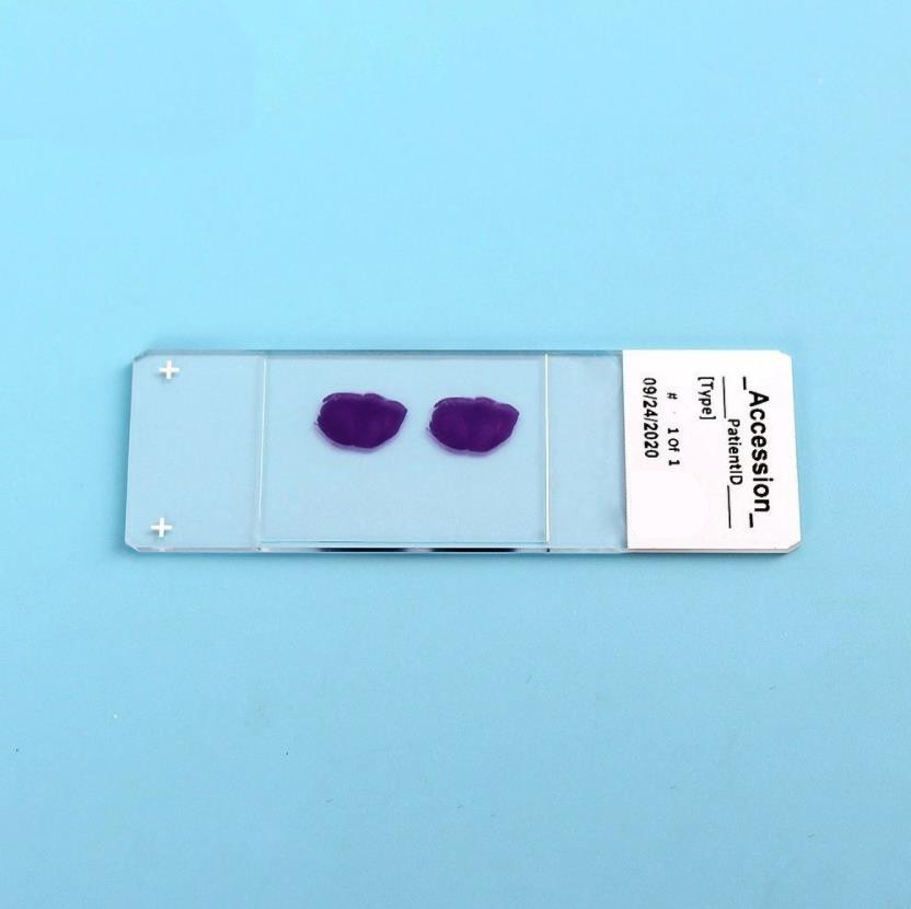 Adhesion Microscope Slide(Paraffin Section)